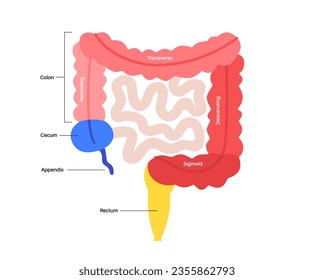 Large intestine anatomical poster. Sections of the human bowel. Digestive tract examination and treatment in gastroenterology clinic. Infographic of colon for education, isolated vector illustration