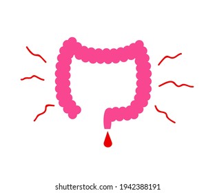 Large intestine on a white background. Constipation. Vector illustration.