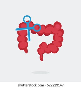 Large intestine surgery vector illustration