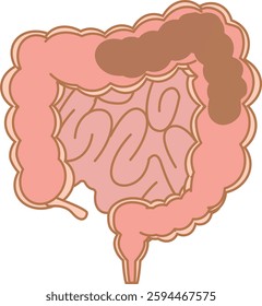 Large intestine undergoing regular bowel movements