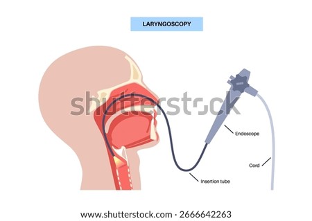 Laryngoscopy medical procedure. Visualization of the larynx and vocal cords using a rigid endoscope. Diagnostic of the airway obstruction, vocal cords and pathologies of the throat evaluation vector
