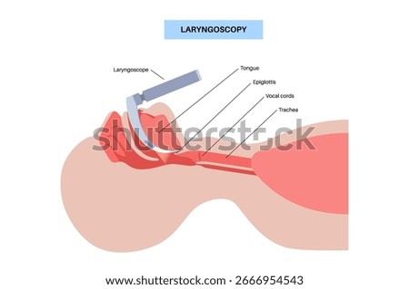 Laryngoscopy medical procedure. Visualization of the larynx and vocal cords using a rigid endoscope. Diagnostic of the airway obstruction, vocal cords and pathologies of the throat evaluation vector