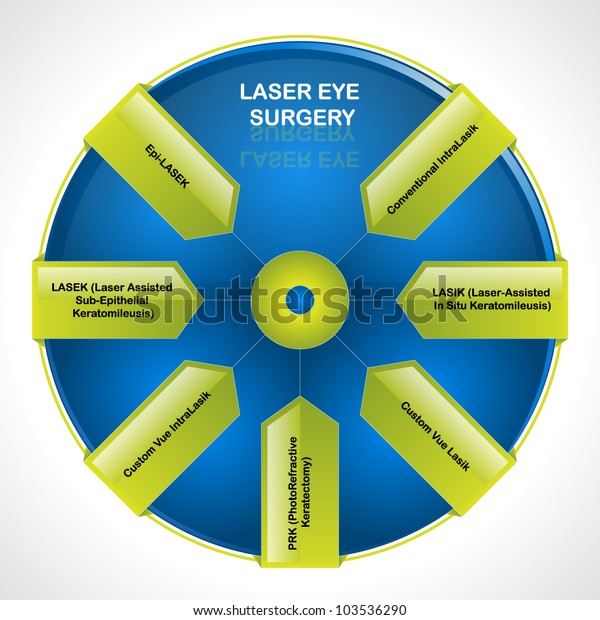 Laser Eye Surgery Diagram Stock Vector (Royalty Free) 103536290