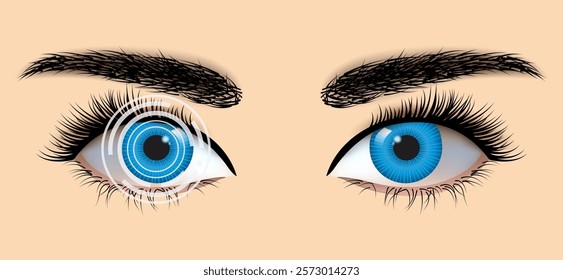 Laser eye surgery and glaucoma concept, close-up of eye with grid or target overlay