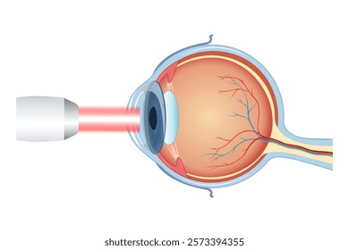 Laser eye surgery and glaucoma concept, close-up of eye with grid or target overlay