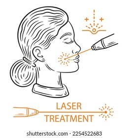 Tratamiento de la piel de la cara láser, procedimiento de belleza antiedad, icono del contorno de la depilación facial. Acné de limpieza médica, terapia de rejuvenecimiento. Mujer con dispositivo de cosmetología de rayos claros. Vector de higiene del cuidado corporal