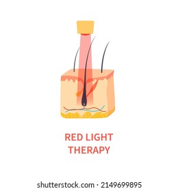 Laser hair growth stimulation. Red light therapy for hair restoration in androgenetic alopecia. Medical concept. Vector illustration.