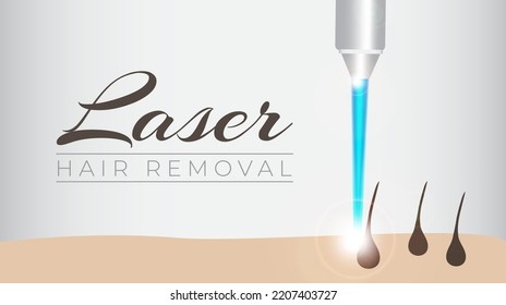 Laser Hair Removal Background Illustration Design 