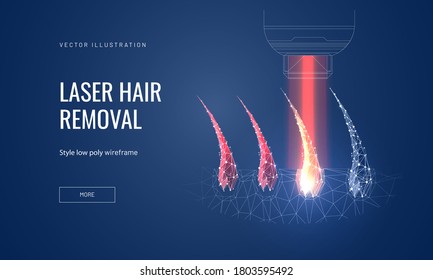 Laser hair removal concept in polygonal futuristic style for banner. Vector illustration of a demonstration of the process of laser epilation, hair follicles with lus from the apparatus