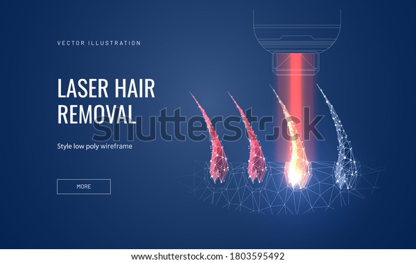 Laser hair removal concept in polygonal\
futuristic style for banner. Vector illustration of a demonstration\
of the process of laser epilation, hair follicles with lus from the\
apparatus