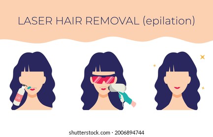 Laser hair removal on the face. Stages of the procedure. Vector illustration of a young woman in cartoon style