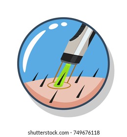 Laser Hair Removal Vector Cartoon Illustration Isolated On A White Background.