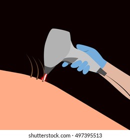 Laser Hair Removal. Vector Illustration