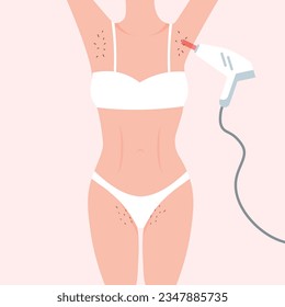 Laser hair removal. Woman hairy armpits and bikini area. Female beauty salon poster. Vector illustration in a trendy flat style isolated.