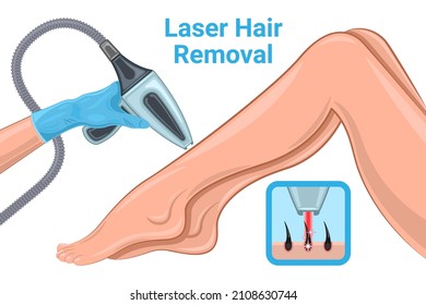 Laser Hair Removal Woman Legs isolated white background