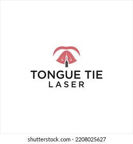 Laser Operation Treatment For Tongue Tie Lip Logo Design 