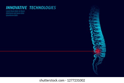 Laser Physiotherapy Human Spine Injury. Pain Area Surgery Operation Modern Loin Medicine Technology Low Poly Triangles 3D Render Female Back Hernia Vector Illustration