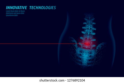 Laser Physiotherapy Human Spine. Pain Area Surgery Operation Modern Medicine Technology Low Poly Triangles 3D Render Female Back Hernia Vector Illustration