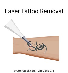 Procedimento de remoção de tatuagem a laser, ilustração vetorial