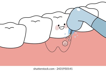 tratamiento láser para el cuidado oral y el diente, diente de limpieza - ilustración plana 