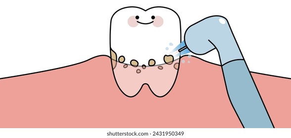 laser treatment for oral care and tooth, cleaning tooth - flat illustration 