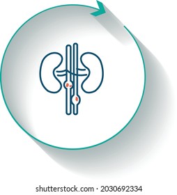 Laser treatment for Ureteral Stones