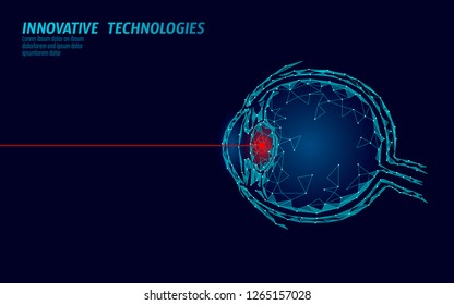 Laser vision correction medicine operation concept. Innovation technology health care. Eye 3D low poly polygonal triangle biometric scanner. Ophthalmology human eyeball banner vector illustration