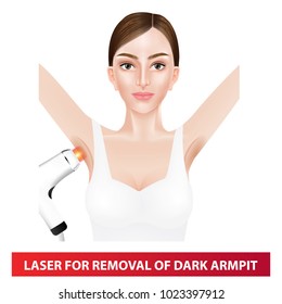 Laser for whitening armpit before and after vector illustration