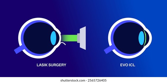 LASIK and EVO ICL eye surgery. Correction of vision diseases. Nearsightedness, farsightedness, astigmatism treatment with laser or lens implantation. Safe painless procedure human eye medical vector