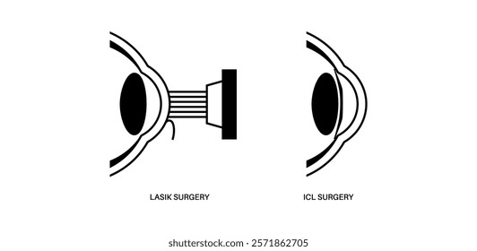 LASIK and EVO ICL eye surgery. Correction of vision diseases. Nearsightedness, farsightedness, astigmatism treatment with laser or lens implantation. Safe painless procedure human eye medical vector