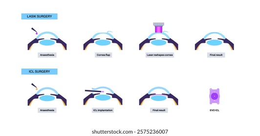 LASIK and EVO ICL eye surgery. Correction of vision diseases. Nearsightedness, farsightedness, astigmatism treatment with laser or lens implantation. Safe painless procedure human eye medical vector