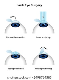 Lasik eye surgery steps procedure 