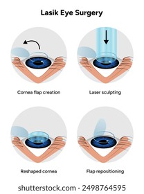 Lasik eye surgery steps procedure 