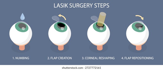 Procedimiento de pasos de cirugía ocular de Lasik (adormecimiento, creación de colgajo, remodelación de la córnea, reposicionamiento del colgajo). Ilustración vectorial isométrica plana 3D sobre fondo oscuro.