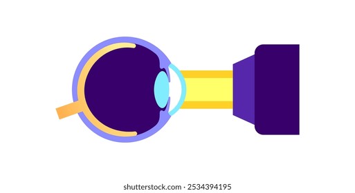 Cirurgia do olho a laser LASIK. Correção de problemas de visão como miopia, hipermetropia e astigmatismo. Procedimento seguro indolor remodela a córnea, olho humano ilustração de vetor plano anatômico