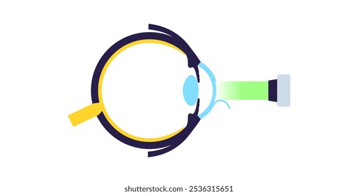 LASIK laser eye surgery. Correction of vision issues like nearsightedness, farsightedness, and astigmatism. Safe painless procedure reshapes the cornea, human eye anatomical flat vector illustration