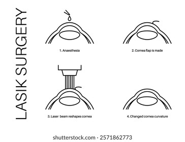 LASIK laser eye surgery. Correction of vision issues nearsightedness, farsightedness, and astigmatism. Safe painless procedure reshapes the cornea, human eye anatomical outline vector illustration