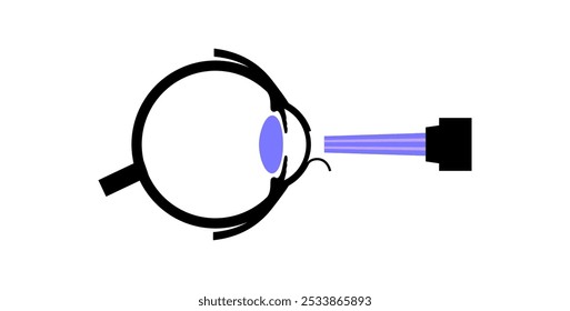 LASIK ícone de cirurgia ocular a laser. Correção de problemas de visão miopia, hipermetropia e astigmatismo. Procedimento seguro indolor remodela a córnea, olho humano ilustração de vetor plano anatômico