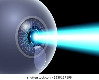 LASIK laser eye surgery poster. Correction of vision issues nearsightedness, farsightedness, astigmatism. Safe painless procedure, reshapes cornea, human eye anatomical 3D vector medical illustration