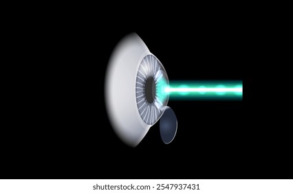 LASIK laser eye surgery poster. Correction of vision issues nearsightedness, farsightedness, astigmatism. Safe painless procedure, reshapes cornea, human eye anatomical 3D vector medical illustration