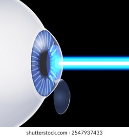 Afiche de cirugía ocular con láser LASIK. Corrección de problemas de visión miopía, hipermetropía, astigmatismo. Procedimiento seguro e indoloro, remodela la córnea, Vector anatómico 3D del ojo humano ilustración médica