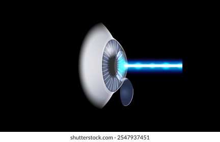 Afiche de cirugía ocular con láser LASIK. Corrección de problemas de visión miopía, hipermetropía, astigmatismo. Procedimiento seguro e indoloro, remodela la córnea, Vector anatómico 3D del ojo humano ilustración médica
