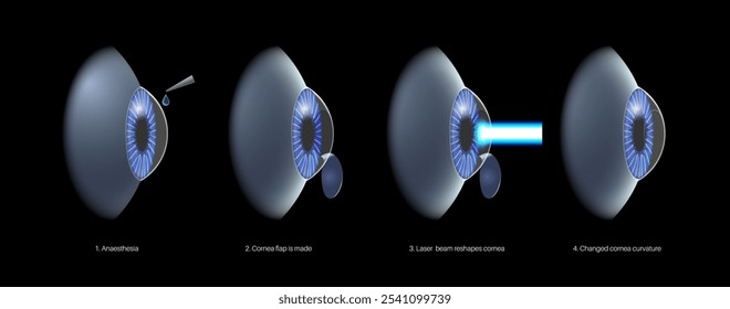 LASIK laser eye surgery process. Correction of vision issues nearsightedness, farsightedness, astigmatism. Safe painless procedure reshapes cornea human eye anatomical 3D realistic vector illustration