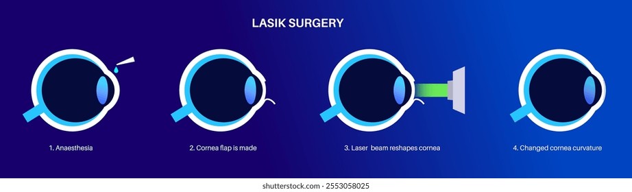 LASIK laser eye surgery process. Correction of vision issues nearsightedness, farsightedness, astigmatism. Safe painless procedure reshapes cornea human eye anatomical poster flat vector illustration