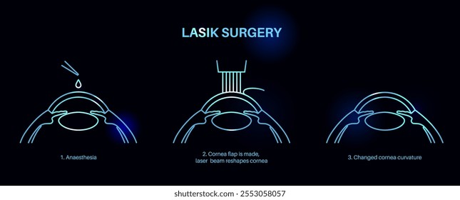 LASIK laser eye surgery process. Correction of vision issues nearsightedness, farsightedness, astigmatism. Safe painless procedure reshapes cornea human eye anatomical poster neon vector illustration