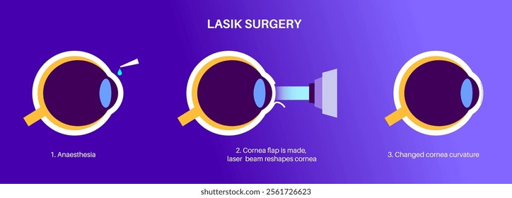 LASIK laser eye surgery process. Correction of vision issues nearsightedness, farsightedness, astigmatism. Safe painless procedure reshapes cornea human eye anatomical poster flat vector illustration