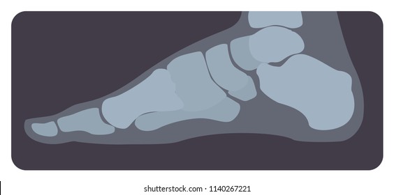 Lateral radiograph of human foot or limb. X-ray picture or radiographic image of metatarsus bones and toes, side view. Modern medical radiography. Monochrome vector illustration in flat cartoon style