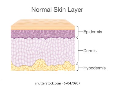 Layer of Healthy Human Skin in vector style and components information. Illustration about medical diagram.