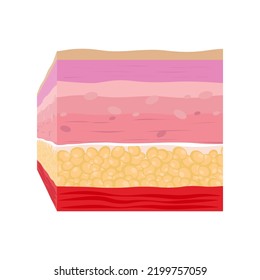 The Layer of Human Skin in vector style and components information. Illustration about medical and health.