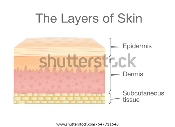 The Layer of Human\
Skin in vector style and components information. Illustration about\
medical and health.